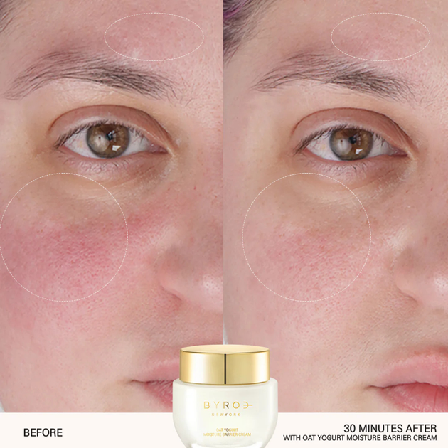 Крем відновлення захисного бар'єру чутливої шкіри Byroe Oat Yogurt Moisture Barrier Cream 50 мл - зображення 8