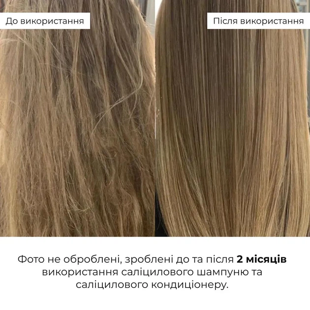 Комплект для глубокой очистки и восстановления волос и кожи головы Шампунь, Кондиционер, Пилинг Hillary Deep Cleanse & Hair Restoration Set K-11-998 - Фото 3 Комплект для глубокой очистки и восстановления волос и кожи головы Шампунь, Кондиционер, Пилинг Hillary Deep Cleanse & Hair Restoration Set K-11-998 - изображение 3