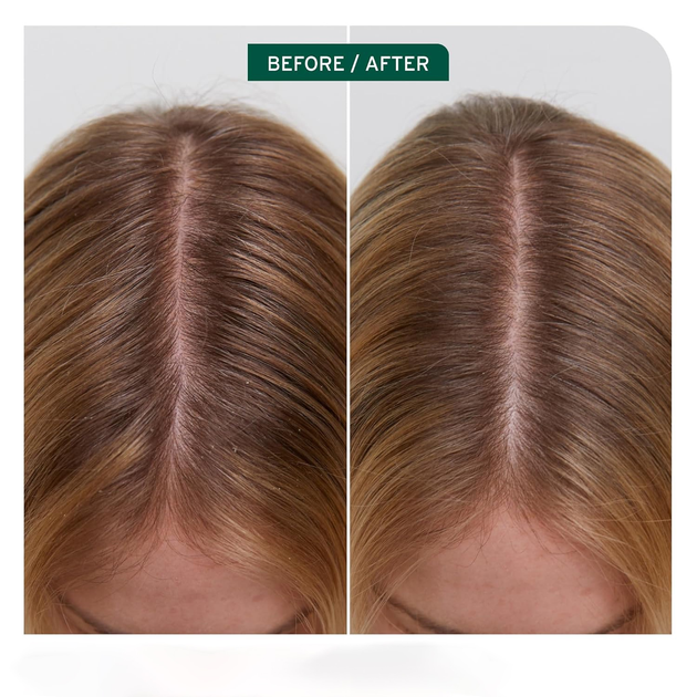 Szampon łagodzący Biolage Scalp Sync dla suchej lub wrażliwej skóry głowy 250 ml (3474637221065) - obraz 2