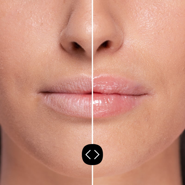 Błyszczyk powiększający usta Freshly Cosmetics Hyaluronic nawilżający 5 ml (8436616950668) - obraz 2