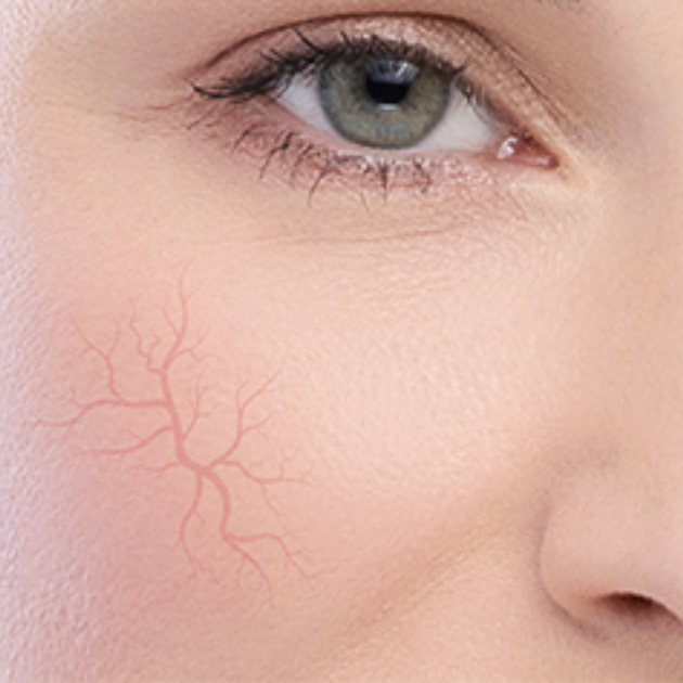 Krem do twarzy Dermedic Redness Calm na trądzik różowaty 40 ml (5901643176501) - obraz 3