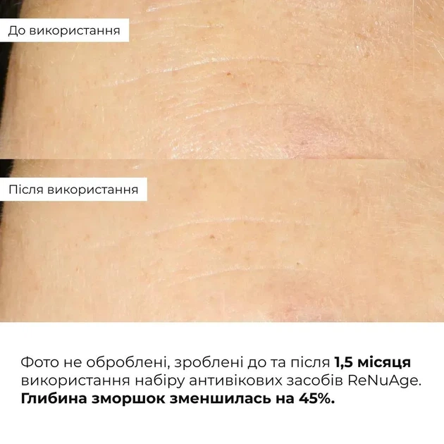 Комплексная антивозрастная система Сыворотка, Крем ReNuAge Total Anti-Aging System K2-08-258 - изображение 9