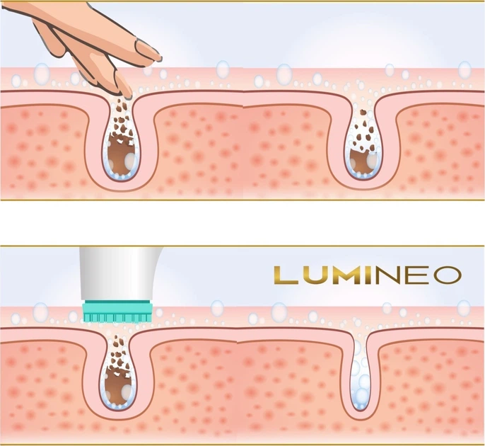 Szczoteczka do twarzy Lumineo Brush Pro 4 końcówki + żel do wszystkich rodzajów skóry turkusowa (5904726872802) - obraz 10