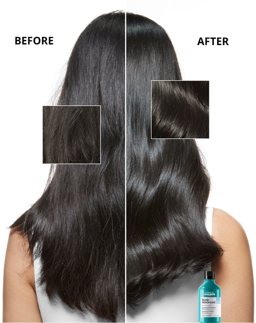 Шампунь проти лупи L'Oreal Professionnel Serie Expert Scalp Advanced очищаючий 300 мл (3474637109387) - зображення 3