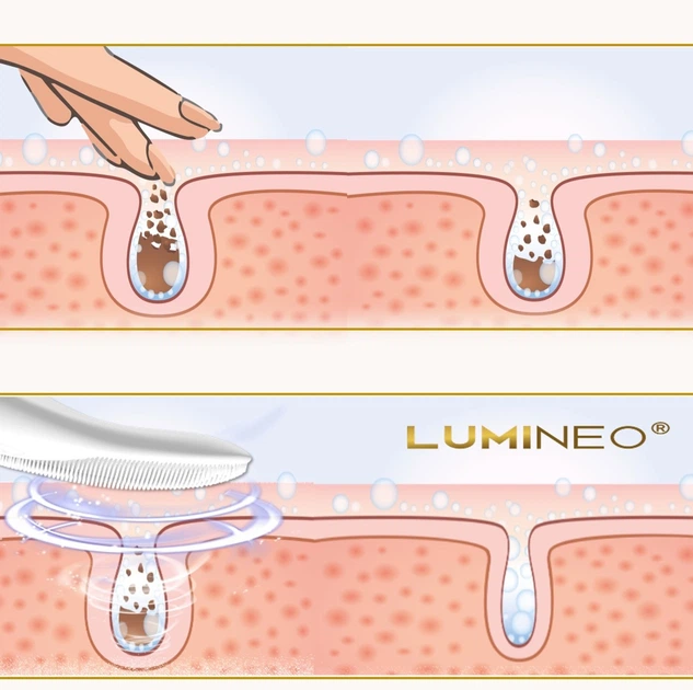 Szczoteczka do twarzy Lumineo Sonic perłowa + żel do wszystkich rodzajów skóry (5904726872734) - obraz 12