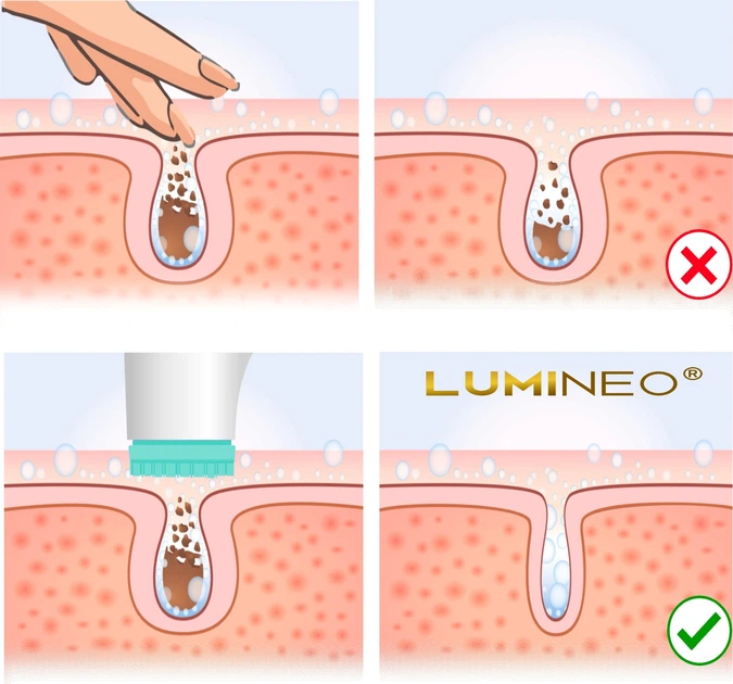 Szczoteczka do twarzy Lumineo Brush Classic 3 końcówki + żel do wszystkich rodzajów skóry (5904726872482) - obraz 6