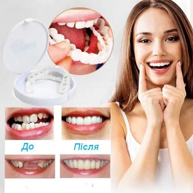 Виниры для зубов верх Snap On Smile легкие в использовании подходят каждому - изображение 7