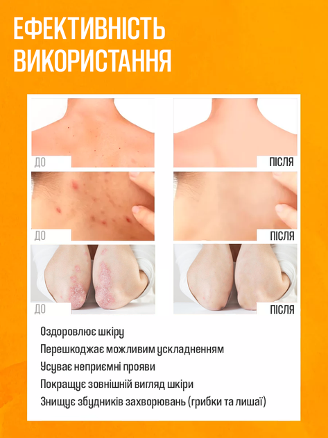 Китайский крем от псориаза Yiganerjing "Chinese Medicine Cream" антисептическая, противогрибковая, лечебная мазь на травах для проблемной кожи при высыпаниях / дерматите / экземе (15 г) - изображение 4