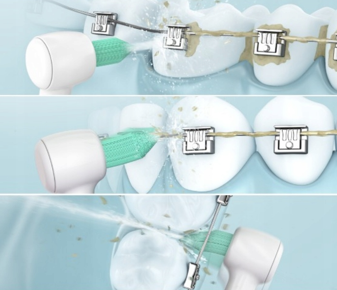 Ирригатор Panasonic EW1313G DentaCare [69900] - изображение 4