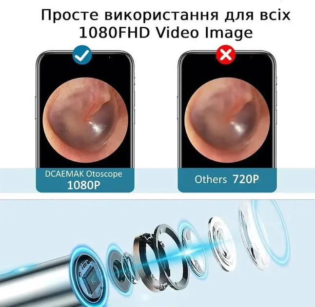Отоскоп аккумуляторный DCAEMAK Р50, с камерой для детального обзора и эффективного удаления серы, черный - Фото 2 Отоскоп аккумуляторный DCAEMAK Р50, с камерой для детального обзора и эффективного удаления серы, черный - изображение 2