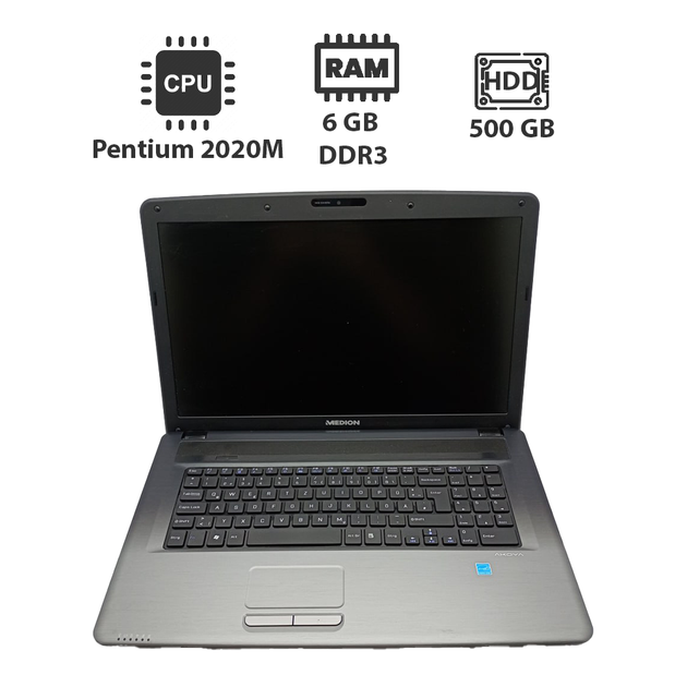 Ноутбук Acer Medion / 17.3" (1600x900) TN / Intel Pentium 2020M (2 ядра по 2.4 GHz) / 6 GB DDR3 / 500 GB HDD / Intel HD Graphics / WebCam б/у - Фото 1 Ноутбук Acer Medion / 17.3" (1600x900) TN / Intel Pentium 2020M (2 ядра по 2.4 GHz) / 6 GB DDR3 / 500 GB HDD / Intel HD Graphics / WebCam б/у - изображение 1