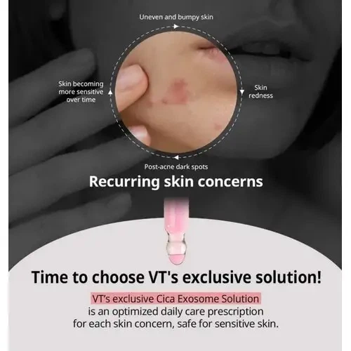 VT A1 Calming Ampoule – заспокійлива ампула з 5% азелаїновою кислотою та центеллою для чутливої шкіри - Фото 4 VT A1 Calming Ampoule – заспокійлива ампула з 5% азелаїновою кислотою та центеллою для чутливої шкіри - зображення 4