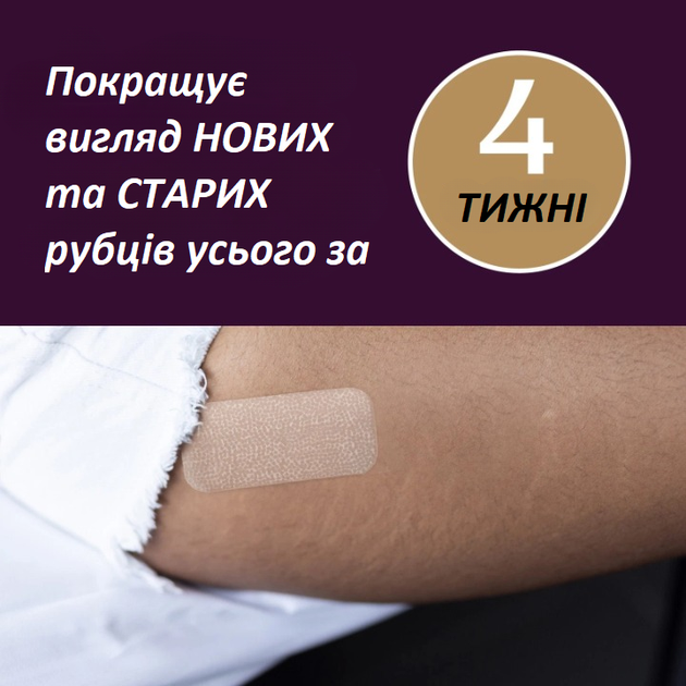 Пластирі для корекції шрамів Mederma Silicone Small 4 штуки 3,5 х 7,6 см - зображення 6
