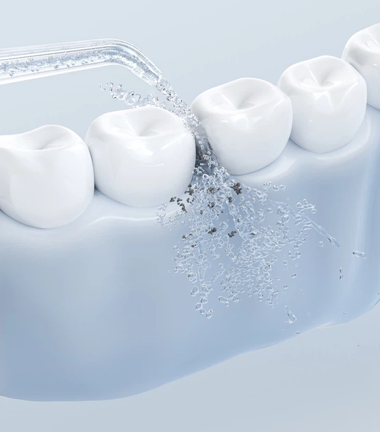 Іригатор Jimok S5 Yellow - зображення 3