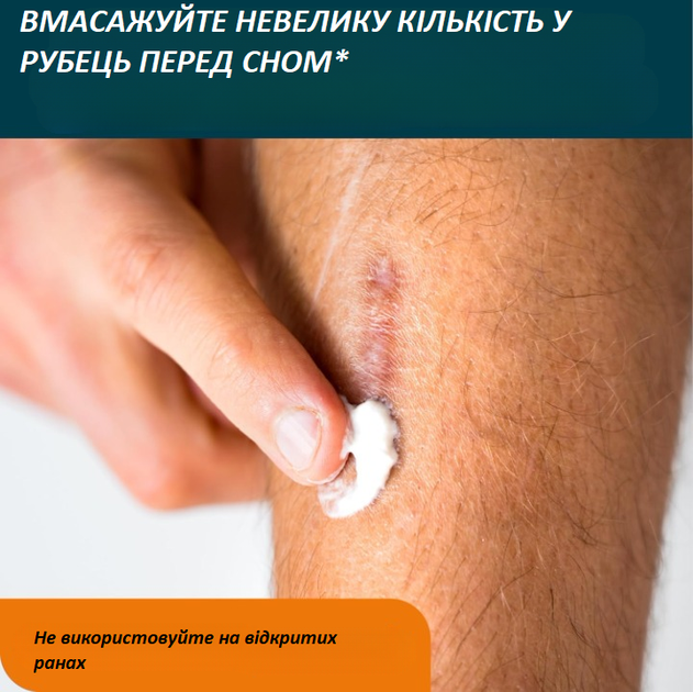 Набір для догляду за рубцями Nuvadermis Silicone Scar Tape & Overnight Intensive Scar Cream Duo (крем 40 мл і пластир 4 см × 300 см) - зображення 6