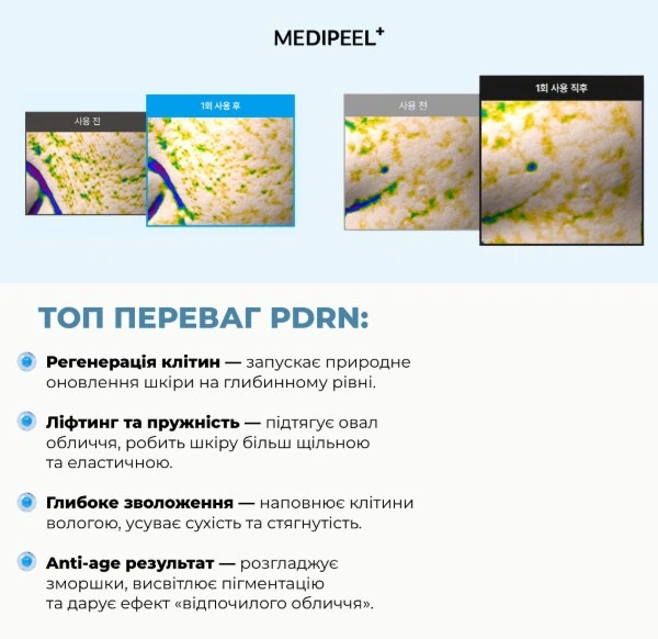 Капсульний гель-крем з PDRN, пептидами та вітамінами для пружності та сяйва шкіри MEDI PEEL PHYTO EX PDRN LIFTING SHOT DROP GEL CREAM 50 мл - зображення 2