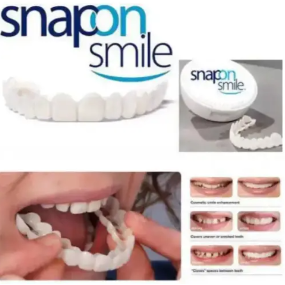 Вініри Snap on Smile Голівудська посмішка комплект 2 шт на вгору та вниз - зображення 2