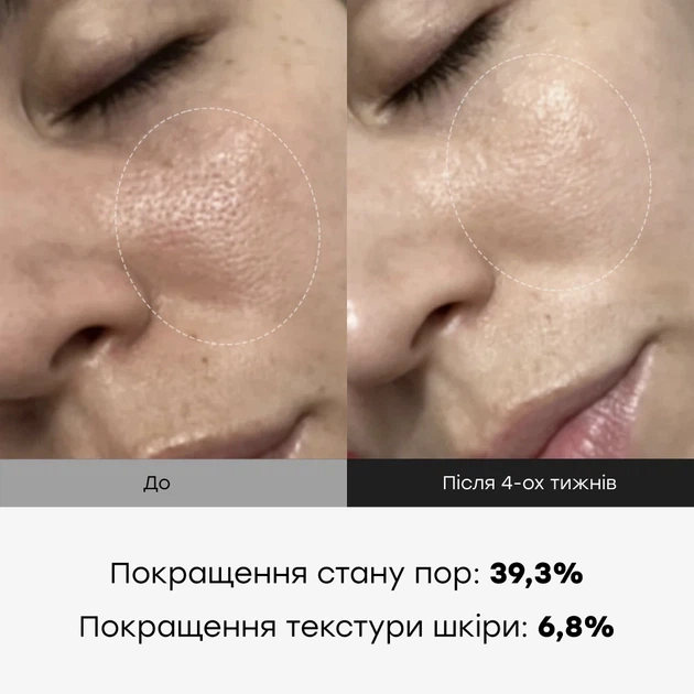 MEDICUBE One Day Exosome Shot Pore Ampoule 2000 Сыворотка с экзосомами и спикулами для сужения пор 2000 - изображение 3