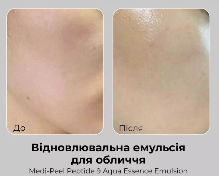Емульсія для обличчя відновлююча з пептидами Medi Peel (Меді Піл) Peptide 9 Aqua Essence Emulsion, 250 мл - изображение 4