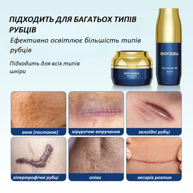 Набір для видалення рубців і шрамів Boysea Advanced Scar Removal Set сироватка 30 мл і крем 30 г - зображення 5