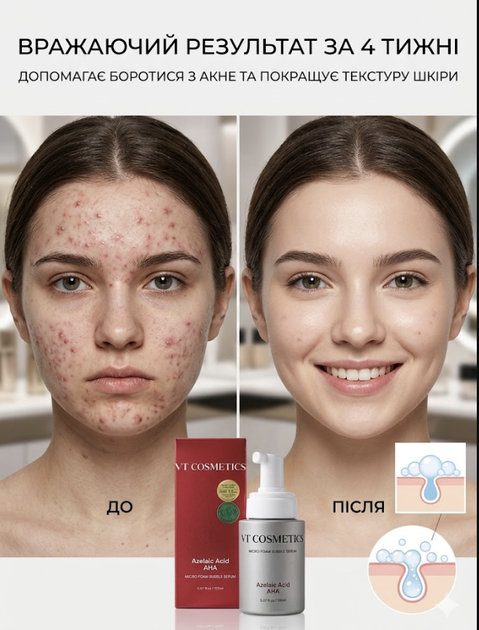 Сыворотка микропенная с AHA,BHA,PHA-кислотами VT Cosmetic AZ AHA RED MICRO BUBBLE SERUM 70 ml - изображение 5