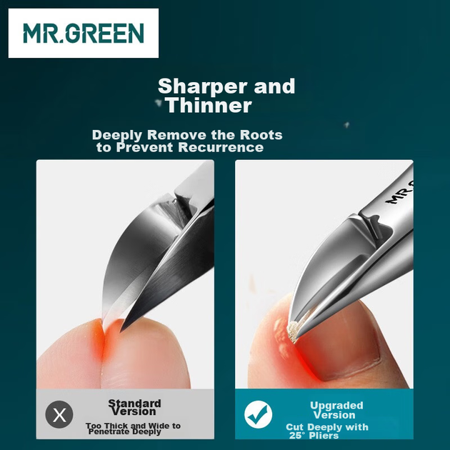 Кусачки MR.GREEN Mr-1036GRplus для вросшего ногтя немецкие, плоскогубцы «орлиный клюв», педикюр - изображение 5