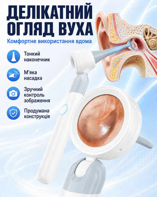 Отооскоп диагностический с экраном 1,38 дюйма 1080P камерой и подсветкой перезаряжаемый прибор для осмотра ушей носа кожи для взрослых детей и животных с 12 силиконовыми насадками и USB-кабелем белый - изображение 8