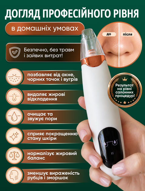 Вакуумный очиститель пор чистящее устройство для удаления черных точек пилинг вакуумный массаж чистящий аппарат (WSC-03) - изображение 2