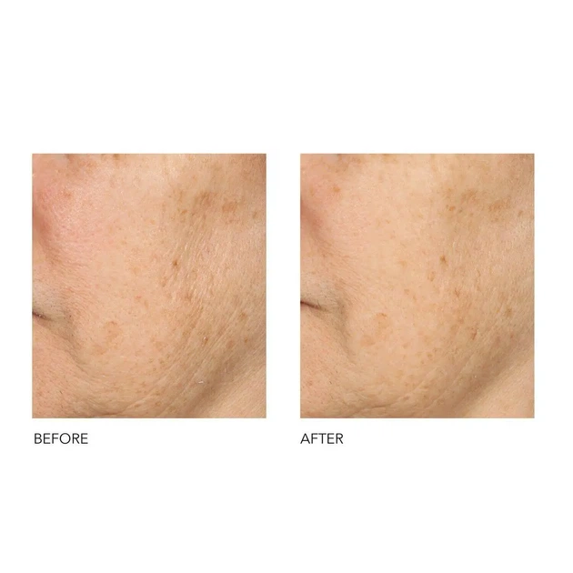 Салфетки для пилинга лица dr.dennis gross skincare alpha beta universal daily peel 3шт - Фото 3 Салфетки для пилинга лица dr.dennis gross skincare alpha beta universal daily peel 3шт - изображение 3