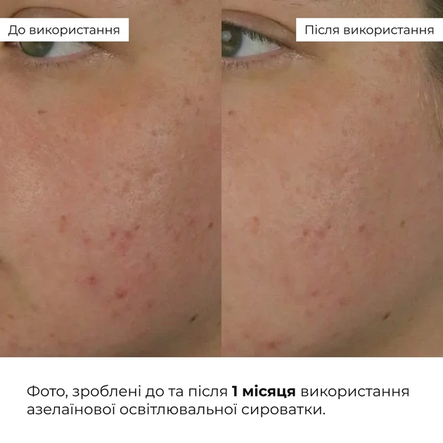 Крем для тела SPF 50+ Hillary Pigmentation Brightening 150 мл дерматокосметика - Фото 7 Крем для тела SPF 50+ Hillary Pigmentation Brightening 150 мл дерматокосметика - изображение 7