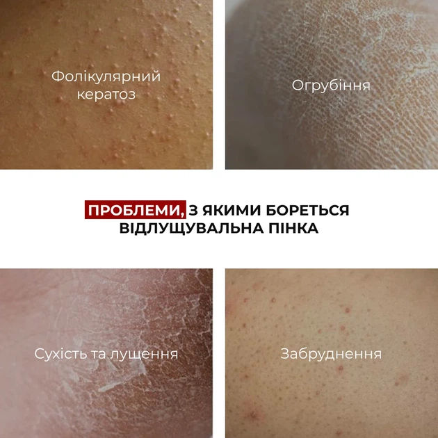 Набор для подготовки кожи и равномерного загара 150 мл Пенка с кислотами + Баттер-автозагар - Фото 7 Набор для подготовки кожи и равномерного загара 150 мл Пенка с кислотами + Баттер-автозагар - изображение 7