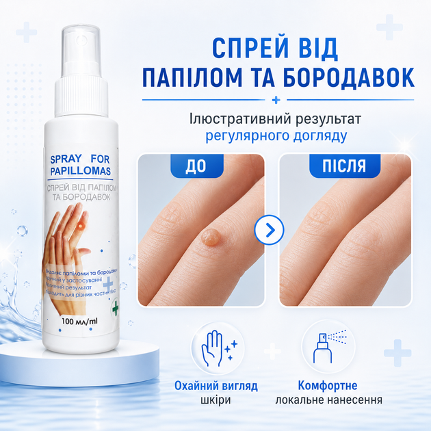 Удаление бородавки быстро и эффективно дома For Removing Skin Formations Средство для кожи от папиллом, 100 мл Удаление папиллом - изображение 9