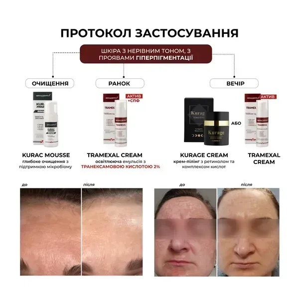 Освітлювальний крем BRADERM Tramexal Cream, 30 мл 00-00000388 - зображення 2