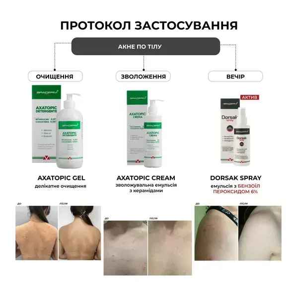 Протизапальний спрей-емульсія BRADERM Dorsak Spray, 100 мл 00-00000385 - зображення 2