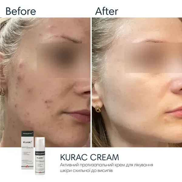 Противовоспалительный крем BRADERM Kurac Cream, 30 мл 00-00000386 - изображение 5