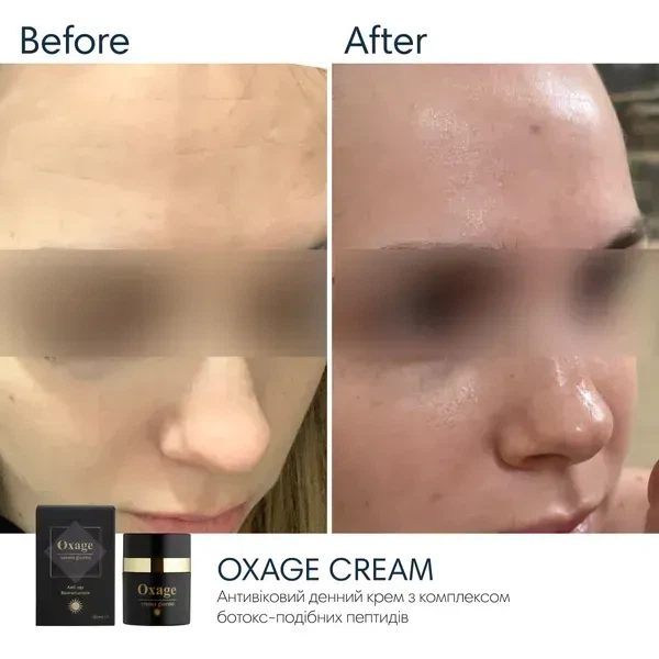 Антивіковий денний крем SPF30 BRADERM Oxage Cream, 30 мл 00-00000430 - зображення 4