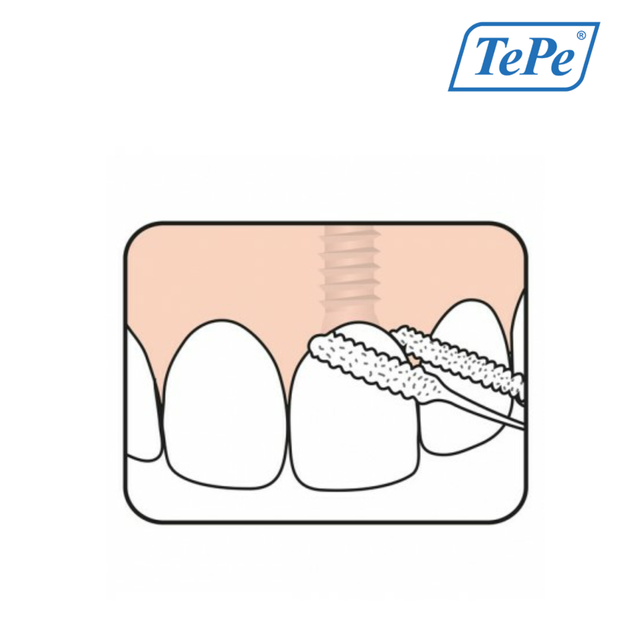 Зубная нить TePe Bridge & Implant для имплантатов, мостов и брекетов, 30 шт - изображение 5