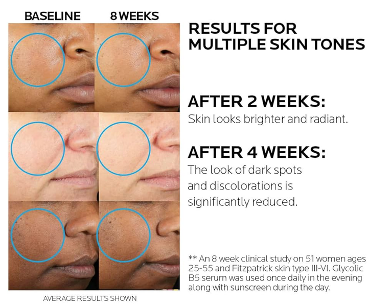 Сыворотка La Roche Posay Glycolic B5 с гликолевой кислотой от темных пятен 30 мл - изображение 3