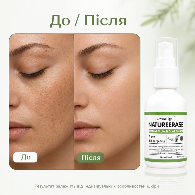 Крем для лица от пигментных Oveallgo NatureErase Instant Mole & Spot Cream Крем против пигментации, 50 мл Борьба с пигментаци - изображение 9