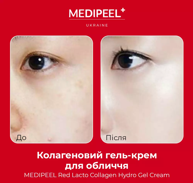 Крем-гель з пептидами та колагеном Medi-Peel Red Lacto Collagen Hydro Gel Cream, 80 мл - зображення 4