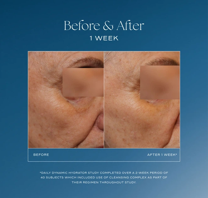 Увлажняющий крем IS Clinical Daily Dynamic Hydrator с технологией GeneXC® 50 г - Фото 5 Увлажняющий крем IS Clinical Daily Dynamic Hydrator с технологией GeneXC® 50 г - изображение 5