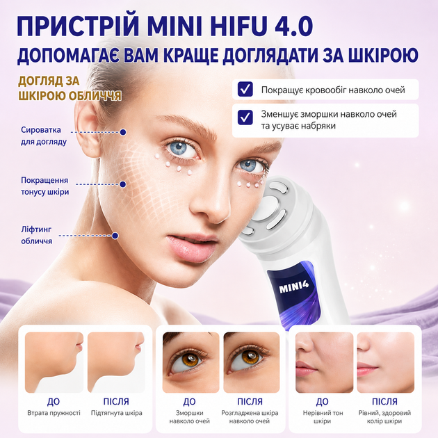 Mini HIFU 4.0 многофункциональный аппарат для лифтинга и омоложения кожи - изображение 2