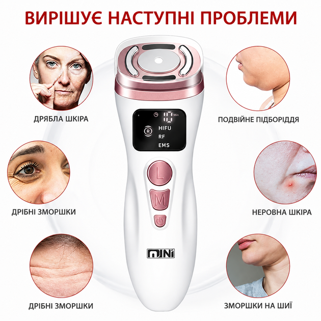 Прибор для RF-лифтинга, омоложения и подтяжки кожи лица UPG Magic Mini HIFU 2.0 - изображение 3