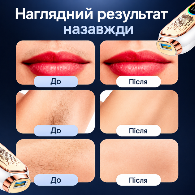 Фотоэпилятор IPL для женщин и мужчин с охлаждением Ice Cooling, 999 999 вспышек, 9 уровней мощности, 3 в 1, 2 насадки - изображение 6