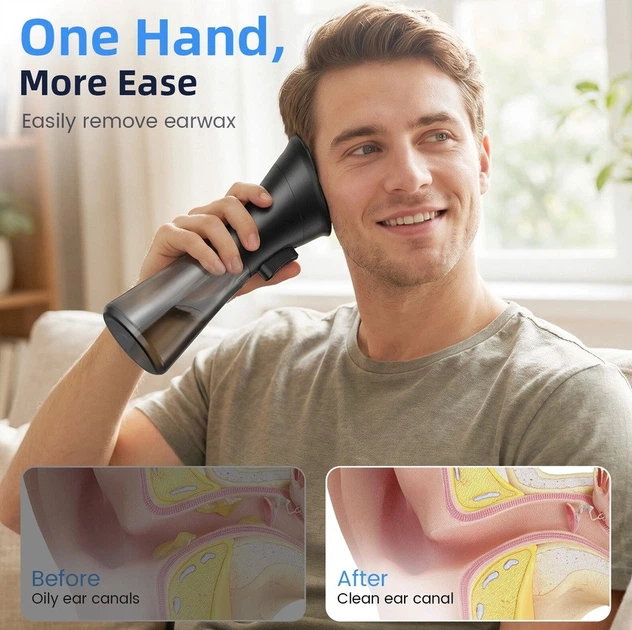 Механический прибор для промывания ушей Ear Wax Removal Kit W12 - изображение 7