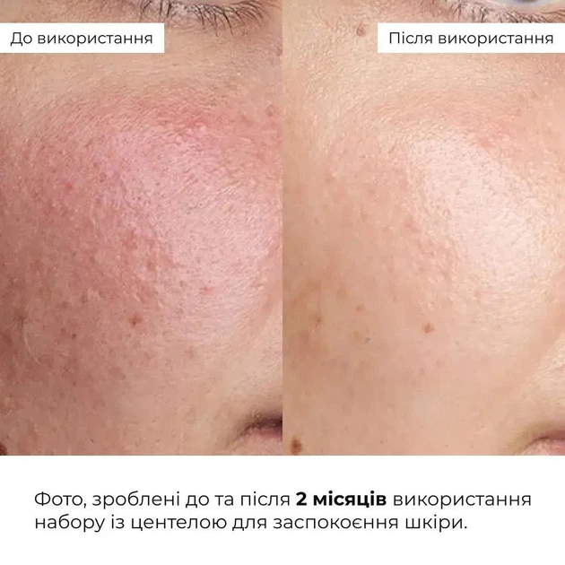 Комплекс ночного ухода для уменьшения видимости морщин Крем, Гель, Патчи HiLLARY K-11-553 - изображение 4