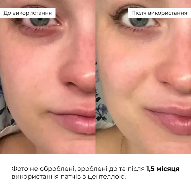 Комплекс ночного ухода для уменьшения видимости морщин Крем, Гель, Патчи HiLLARY K-11-553 - изображение 6