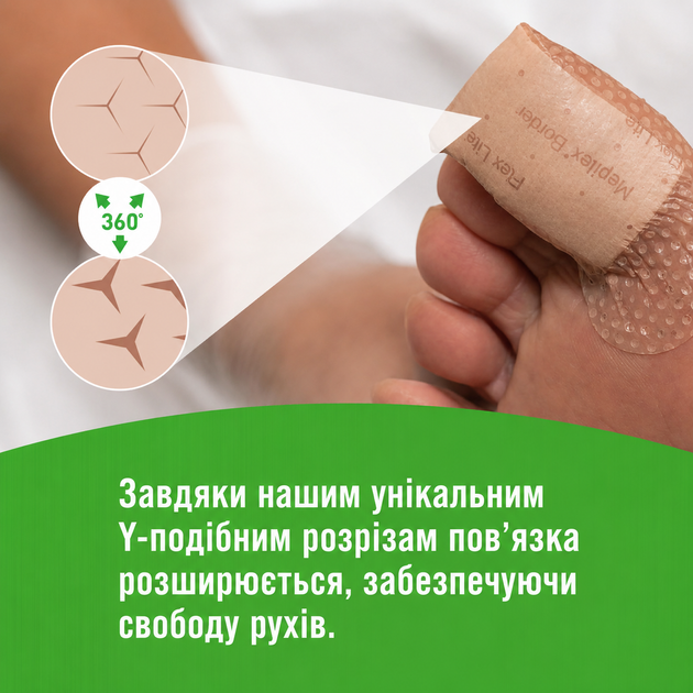 Медицинский водонипроницаемый пластырь Mepilex Border Flex 10 x 10 см для ран и травм кожи 3 шт - изображение 7