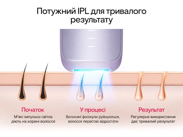 Фотоэпилятор ULIKE Air 3 IPL Lavander с охлаждением Sapphire Ice Cooling для безболезненной эпиляции - Фото 7 Фотоэпилятор ULIKE Air 3 IPL Lavander с охлаждением Sapphire Ice Cooling для безболезненной эпиляции - изображение 7