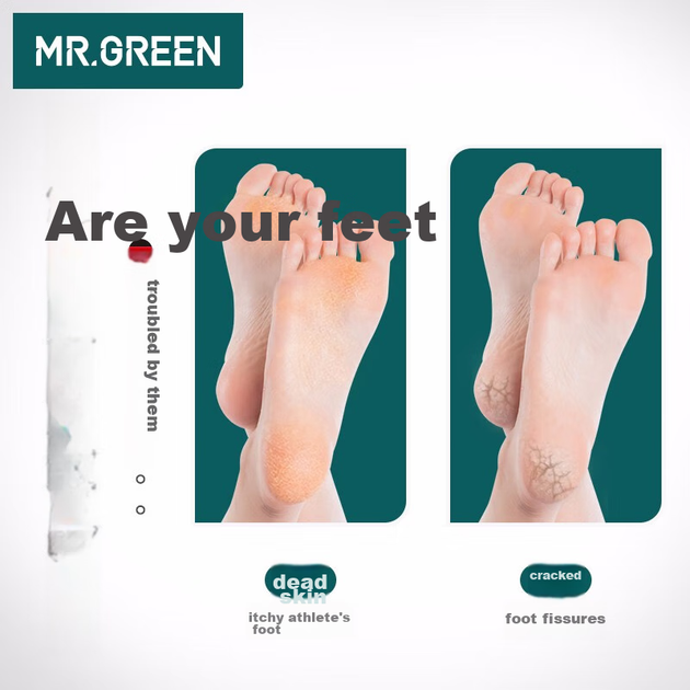 MR.GREEN Німецький двосторонній камінь для чищення ніг для видалення відмерлої шкіри та мозолів, пилка для п'ят, імпортний інструмент Mr-2205GR - зображення 4